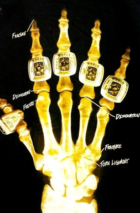 Rich Till I Die!